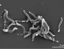 Scanning electron micrograph of D. acetiphilus strain N2460T. From H. Kiss et al, doi.org/10.4056/sigs.892105