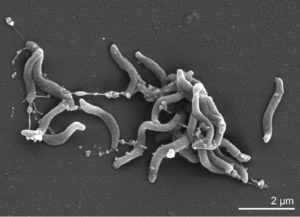 Scanning electron micrograph of D. acetiphilus strain N2460T. From H. Kiss et al, doi.org/10.4056/sigs.892105