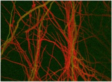 Trichodermaatroviride (red) growing along the hyphae of a host fungus (green).  (Photo by VerenaSeidl, TU Vienna and Nick Read, Univ. of Edinburgh)