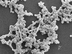 Spathaspora passalidarum, one of the fungi sequenced for this paper  (Courtesy of Thomas Kuster at USDA, Forest Products Lab)