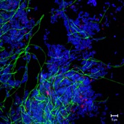 Fluorescence in situhybridization image of Dehalococcoidescells (pink)  in a dechlorinatingmethanogenicculture. (Courtesy of Natuschka M. Lee, Technical University of Munich, Germany and Frank E. Löffler, Georgia Institute of Technology, USA)