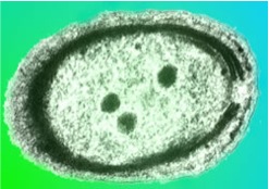 Prochlorococcus is one of the ocean’s most abundant primary producers.  (Claire Ting, Department of Biology, Williams College)