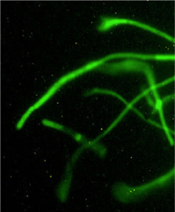 A fungal pathogen (C. sativus) from the Dothideomycetesfamily can cause severe economic losses to barley, a potential biofuels feedstock. (ShaobinZhong, North Dakota State University)