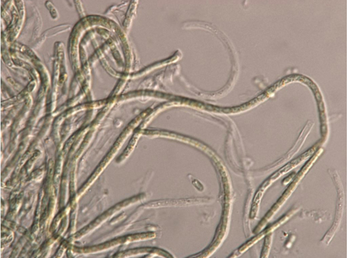 Photo: Filaments of JSC-12 seen through Nomarsky mode of microscopy. (Courtesy of Igor Brown, NASA Johnson Space Center)