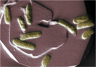 Shewanella oneidensis strain MR-1 could have bioremediation applications for DOE sites contaminated during the manufacture of nuclear weapons.