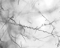 Coiling of Trichoderma hyphae around Rhizoctonia (a basidiomycete pathogen). The coiling response of T. virens is induced by the presence of host hyphae and precedes penetration of the host.