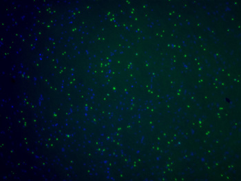 Photo: Cells from culture HB-F7 with Crenarchaea (green) and bacteria (purple) visualized by fluorescent in situ hybridization with an archaeal-specific probe, courtesy of Annika Mosier