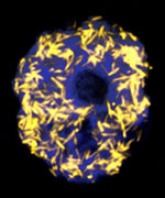 Candidatus Amoebophilus in an amoeba host cell, visualized by fluorescence in-situ hybridization with symbiont-specific probes.