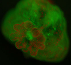 Fluorescence micrograph of Acropora coral with algal symbiont