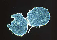 Dark-field photo of Frankia vesicle clusters (single plant cells filled with the filamentous organism) that have broken free from nodules in the plant Coriaria arborea.