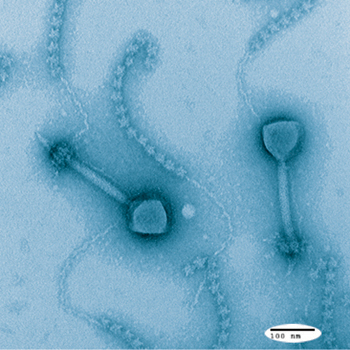 Photo: Marine virus, sample from Tara Station 23 & 30, isolated from Synechococcus. Image by Jennifer Brum, Tucson Marine Phage Lab