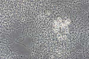 Micromonospora strain L5. Micrograph courtesy Ann M. Hirsch.