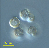 Diffraction interference contrast micrograph of P. antarctica colony with five cells embedded in a carbohydrate matrix. Photo courtesy Oliver Killian and Gry Mine Berg.