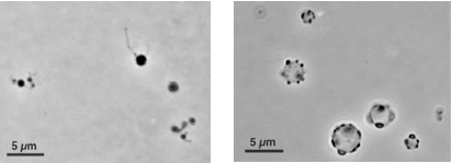 Phase contrast micrographs of Sphaerochaeta pleomorpha strain Grapes (left) and Sphaerochaeta globus strain Buddy (right) by Kirsti Ritalahti and Frank Loeffler, Georgia Institute of Technology