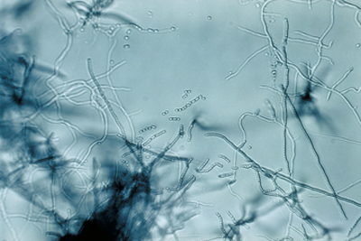 Photo: CDC/Dr. David Berd (PHIL #2983), 1972