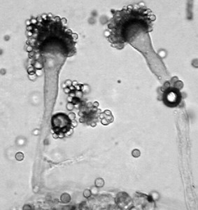 Eurotium rubrum's reproductive structures