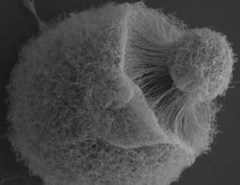 Cryptococcus neoformans giant cell SEM