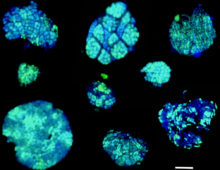 AOM consortia oxidizing methane seen using BONCAT