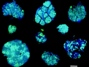 AOM consortia oxidizing methane seen using BONCAT