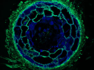 The crosscut shows the fungal tissues - the fungal mantle around the root tip and the the fungal network of tendrils that penetrates the root of plants, or Hartig Net, between Pinus sylvestris plant root cells - in green. (Image by Maira de Freitas Pereira, INRA Nancy.)