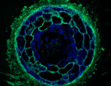 The crosscut shows the fungal tissues - the fungal mantle around the root tip and the the fungal network of tendrils that penetrates the root of plants, or Hartig Net, between Pinus sylvestris plant root cells - in green. (Image by Maira de Freitas Pereira, INRA Nancy.)