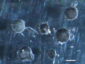 Shown here are the sclerotia, the resistant propagules formed and frequently found in soils. (Martina Peter, Swiss Federal Research Institute WSL) 