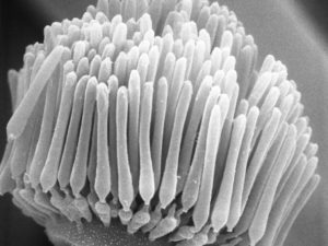 Linderina pennispora ZyGoLife Research Consortium Flickr CC BY-SA 2.0