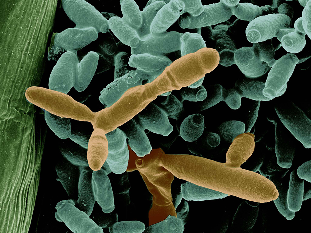 Nectar yeast, Metschnikowia gruessii. (Manpreet Dhami, Tadashi Fukami, and Lydia-Marie Joubert)