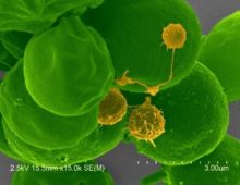 Vampirovibrio chlorellavorus in yellow on green host. (Courtesy of Judith Brown)