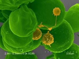 Vampirovibrio chlorellavorus in yellow on green host. (Courtesy of Judith Brown)