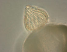 Blyttiomyces helicus on spruce pollen grain. (Joyce Longcore)