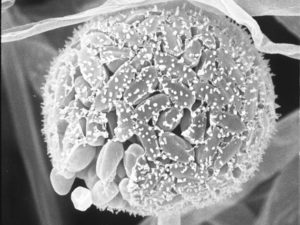 Parasitella parasitica (ZyGoLife Research Consortium on Flickr, CC BY-SA 2.0)