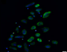 FISH of Nha-C enrichment with Hrr. lacusprofundi ACAM34-hmgA. Fluorescence micrograph shows individual Nha-C cells amongst Hrr. lacusprofundi cells. Nha-C cells labelled with a Cy5 (red fluorescence) conjugated probe; Hrr. lacusprofundi cells labelled with a Cy3 (yellow fluorescence, recolored to green to improve contrast) probe; all nucleic-acid containing cells stained with DAPI (blue fluorescence). Composite image of all three filters. Scale bars represent 2 µm. (Josh Hamm, UNSW)