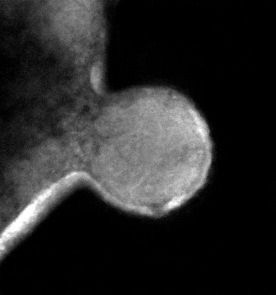 TEM of Nha-C FACS cells with Hrr. lacusprofundi ACAM34. A single ‘budded’ cell (putative Nha-C) intimately associated with a larger cell (putative Hrr. lacusprofundi). (Josh Hamm, UNSW)