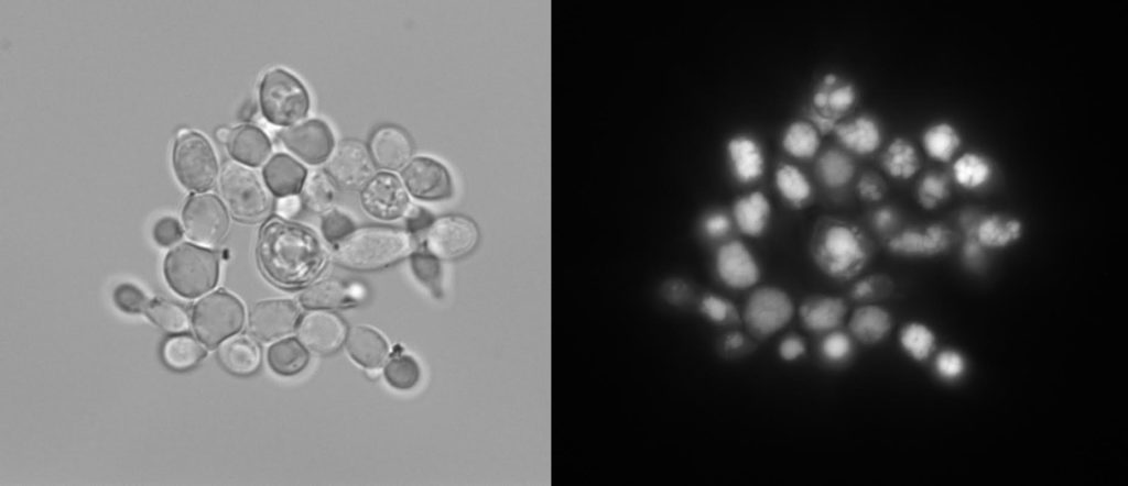 The lipid producing yeast, Yarrowia lipolytica, examined with light microscopy (left) and fluorescence microscopy (right), after being stained with Nile Red to visualize the lipid droplets inside (shown here in white). (Courtesy of Hal Alper)