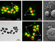 Algae–prokaryote associations in phototrophic high pH–high alkalinity cultures containing Chlorella sorokiniana strain SLA-04. a: algal cells, b: bacterial cells; s: algal sheath. (Images courtesy of Dr. Huyen Bui, Center of Biofilm Engineering, Montana State University)