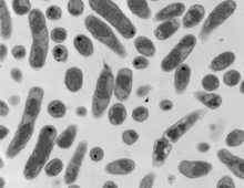 A transmission electron micrograph of Sinorhizobium meliloti strain 1021. The scale bar represents 2 microns. (George diCenzo)