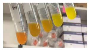 Gradient of the betaxanthins production in yeast across various different cultures. (Courtesy of Matthew Deaner)