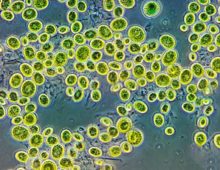 Unicellular algae in the Chlorella genus, magnified 1300x. (Andrei Savitsky)