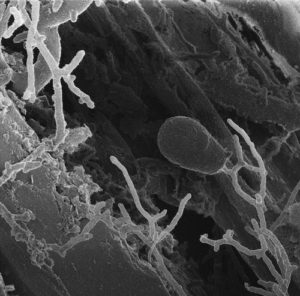 The anaerobic fungus Anaeroromyces robustus growing on reed canary grass. (Vaithiyalingam Shutthanandan, PNNL/EMSL)
