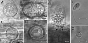 From Sekimoto et al., 2011: Olpidium bornovanus, a unicellular fungus, is an obligate parasite of plants that reproduces with flagellated, swimming zoospores. A-B. Vegetative unicellular thalli in cucumber root cells. Thalli differentiate into sporangia with zoospores, or into resting spores. C. An empty sporangium, after zoospore release. D. A thick-walled resting spore. E. Zoospores being released from a sporangium, showing the sporangium exit tube (arrowheads). F. A swimming zoospore with a single posterior flagellum. G. An encysted zoospore. Bars: A-E = 10 μm; F,G = 5 μm. (Figures are from Sekimoto et. al., 2011 used under a Creative Commons Attribution 2.0 License.)