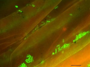 These bright green spots are fluorescently labelled bacteria from soil collected from the surface of plant roots. For reference, the scale bar at bottom right is 10 micrometers long. (Rhona Stuart)