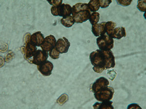 A microscopic image showing a cluster of black cells, which are black fungi. 