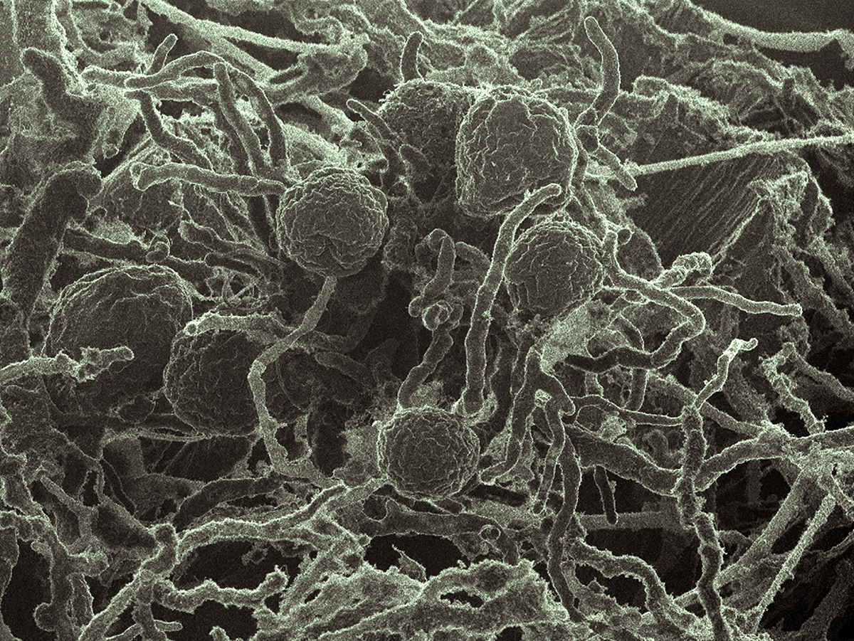 Pictured is a micrograph of Neocallimastix californiae.